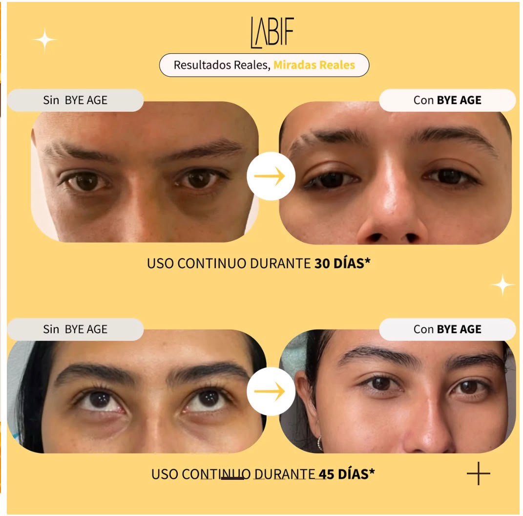 Bye Age Banana Anti-Ojeras LABIF
